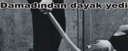 DAMADI TARAFINDAN DARP EDLEN KADIN HASTANELK OLDU