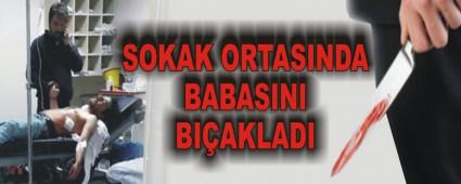 SOKAK ORTASINDA BABASINI BIAKLADI