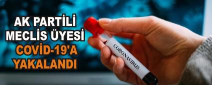 AK PARTL MECLS YES COVD-19\'A YAKALANDI