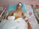 Bomba elinde patlayan �ocuk serbest