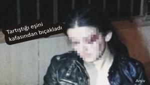 Kar�s�n� kafas�ndan b��aklad�
